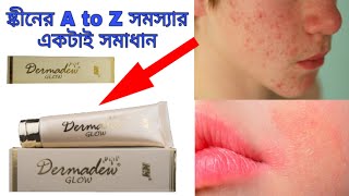 Demelan cream review  हिंदी में  Dr Aanchal Panth [upl. by Dario842]