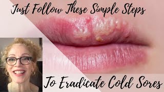 HOW TO TREAT amp ERADICATE COLD SORES [upl. by Tnayrb]