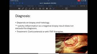 Pathology Vasculitis Part 1 [upl. by Turoff]