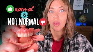 Dentures Whats Normal vs Not Normal [upl. by Tybalt487]