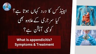 Appendicitis pain symptoms and treatment  Women Health Center [upl. by Harwill]