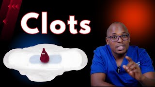 Understanding Menstrual Clots Causes amp Remedies  When to Worry [upl. by Bushore]