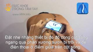 Thước đo cong vẹo cột sống  CÁCH SỬ DỤNG [upl. by Rehpotsihrc355]