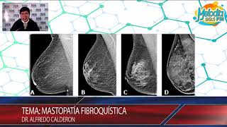 Mastopatia Fibroquistica [upl. by Namus]