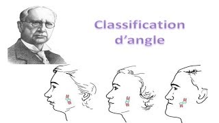 Classification dangle des malocclusions en Orthodontie [upl. by Brenza]