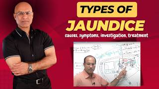 Types Of Jaundice  Causes Symptoms amp Treatment  Dr Najeeb [upl. by Wayland832]