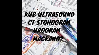 Magkano KUB Ultrasound CT Stonogram at UROGRAM [upl. by Fayina]