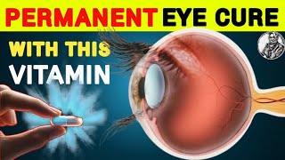 1 Vitamin to Cure Eye Problem Permanently  Eye care Tips  Vitamins eyecare [upl. by Suneya]