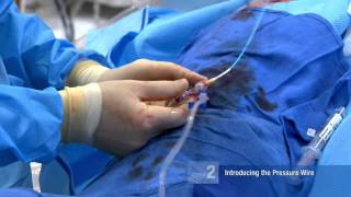 FFR Basics Performing an FFR Procedure  Mort Kern MD [upl. by Jaqitsch]