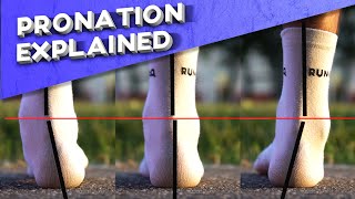 What is overpronation  Pronation types explained [upl. by Croft]