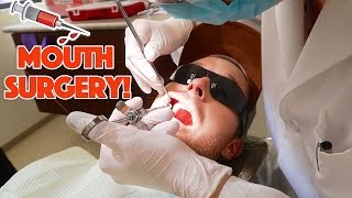 DENTIST MOUTH INFECTION [upl. by Cletis]