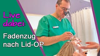 AugenlidOP – Erfahrungsbericht Fäden ziehen nach SchlupflidOP bei Dr Günther Düsseldorf [upl. by Omocaig]