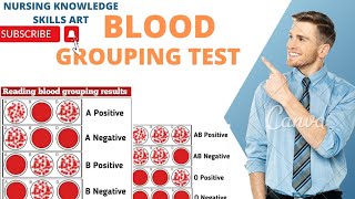 How to Perform Blood Grouping Test very easy method [upl. by Nnyltiak]