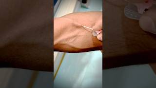 Mastering Canalization A StepbyStep Guide to Expert IV Catheterization highlight toptrending [upl. by Selin233]