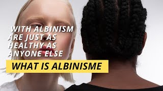 What Is Albinism [upl. by Amena158]