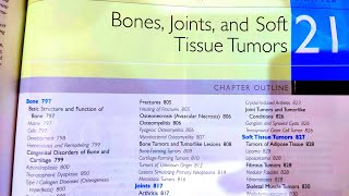 Bone Joints and Soft tissue tummors chapter Robbins pathologyComposition of BoneOsteoclast functin [upl. by Aivatan796]