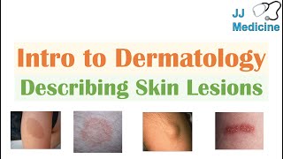 Introduction to Dermatology  The Basics  Describing Skin Lesions Primary amp Secondary Morphology [upl. by Corenda]