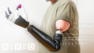 How MindControlled Bionic Arms Fuse To The Body  WIRED [upl. by Pickar]