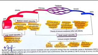 Blood Vessel Pathology 6 Major Topic VasculitisGiant cell and Takayasu Arteritis [upl. by Yraunaj]