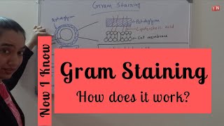 Gram Staining of Bacteria Principle Procedure amp Mechanism [upl. by Machutte]