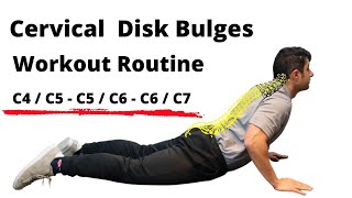 Workout routine for Cervical Disc Bulges  Beginner Level [upl. by Nnaillij]