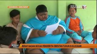 Arya Bocah Obesitas Berhasil Turunkan Berat Badan [upl. by Brendis]