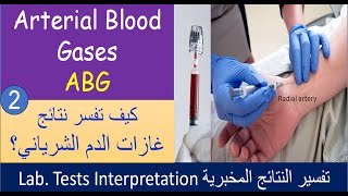 Lecture 2 2 Arterial Blood Gases analysis  ABG [upl. by Ardnazil]