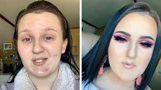 MakeUp Artist With Severe Acne Shares Her Tips [upl. by Perkins316]