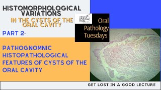 Histomorphological Variations in oral cysts part 2 Histopathology\Oral Pathology 360 Fundamentals [upl. by Horgan]