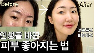 Eng cc 피부과에선 안알려준 돈 안들이고 피부 좋아지는 법✨ 좀 더 일찍 알았더라면🤦🏻‍♀️ [upl. by Nauq]