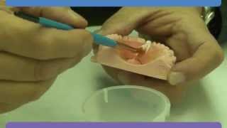 Dentsply Sirona Repair Material [upl. by Orodisi205]