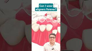 Can I wear Aligners forever [upl. by Sikleb]