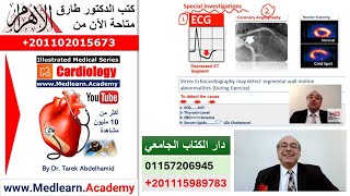 Angina Pectoris cme internalmedicine ecg usmle medical محاضراتباطنة [upl. by Onafets]