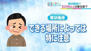 【いっちゃん☆メディコ】帯状疱疹①５０代以上は要注意？ [upl. by Nilcaj]