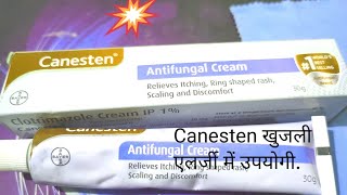 Canesten Antifungal Cream Use खुजलीएलर्जी इन्फेक्शन सफेद पानी में उपयोगी। [upl. by Sascha909]