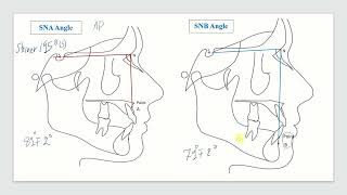 Lecture 7 Cephalometric analysis part 2 [upl. by Tabitha]