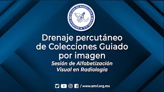 Sesión de Alfabetización Visual en Radiología  Drenaje percutáneo de Colecciones Guiado por imagen [upl. by Trisa208]