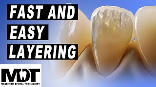 Discover the Fast and Easy emax and Zirconia micro layering method  Quick And Great Results [upl. by Elbys493]