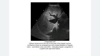 ABDOMEN PELVIS EXPERT DDX [upl. by Magdau]