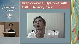 Oromandibular Dystonia and Meige Syndrome Virgilio Gerald H Evidente MD [upl. by Llerud]