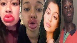 Kylie Jenner Lip Challenge Reaction [upl. by Vinnie625]