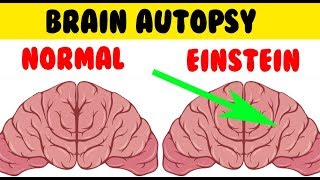 Shocking Differences between Einsteins Brain and Yours  Einsteins Brain Was Stolen and Autopsied [upl. by Amzu184]