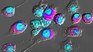 Imaging Macrophage Activation [upl. by Aralomo956]