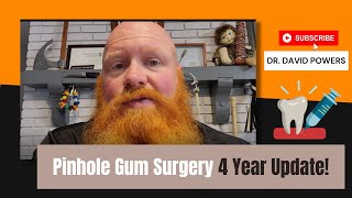 Pinhole Gum Surgery 4 Year Update [upl. by Abisha401]