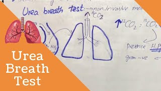 Urea Breath Test  Helicobacter pylori  Infectious Peptic Ulcer [upl. by Secnarfyram]