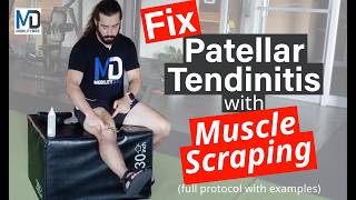 Full Muscle Scraping Protocol for Patellar Tendinitis  Gua Sha Routine [upl. by Enortna947]