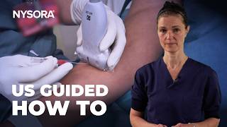 GUIDE TO ULTRASOUNDGUIDED IV ACCESS [upl. by Eiznekcam]