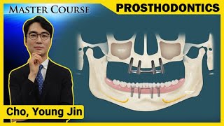 Master Course Season2 PROSTHODONTICS Bar type Overdenture [upl. by Eatnohs]