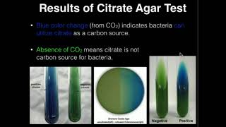 Microbiology Citrate Agar [upl. by Minor]