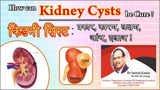 Kidney Cyst Kidney Tumor Kidney Cancer  किडनी सिस्ट  DrProfSantosh Kumar PGI [upl. by Bunder120]